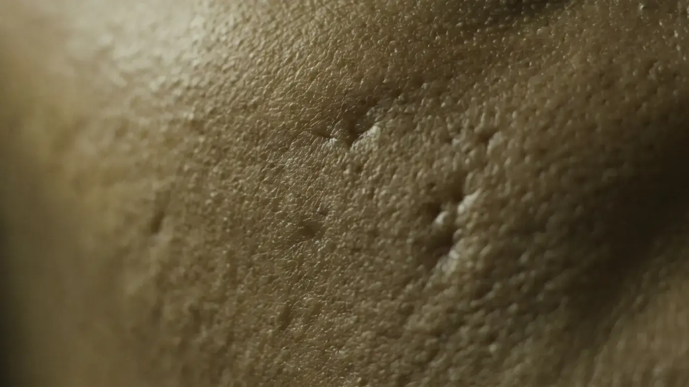 Raking light across skin, showing shallow depressions and uneven surface texture
