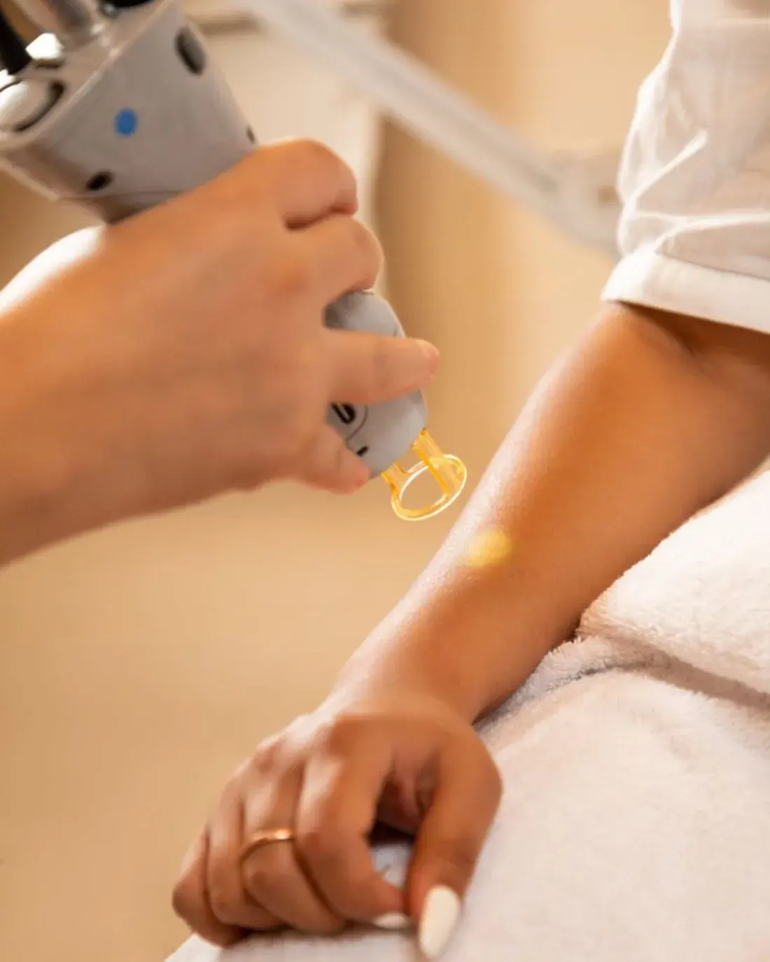 Laser Hair Removal at Shookra, Dubai