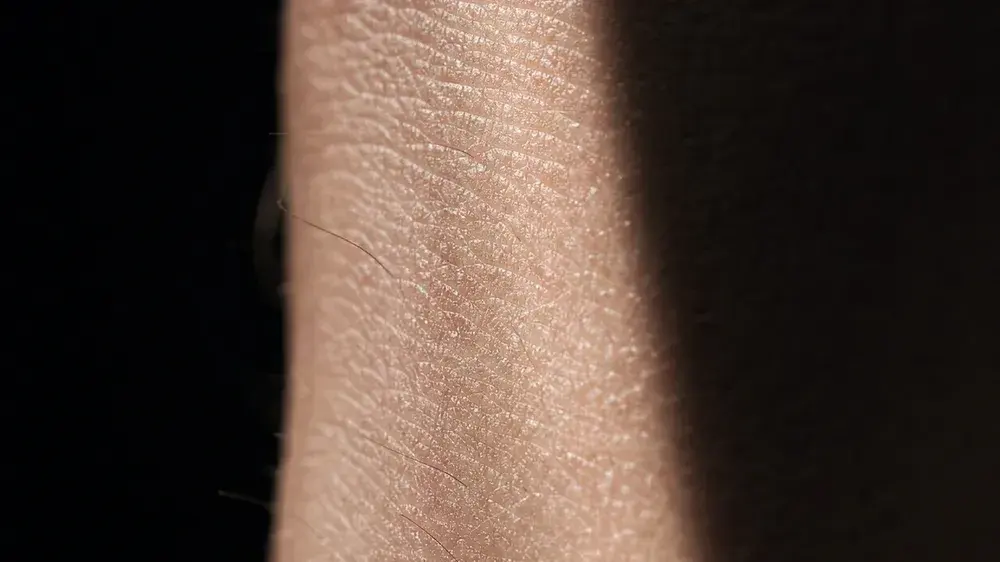 Why Pigmentation Is So Common in Dubai: Sun, Heat and Your Skin