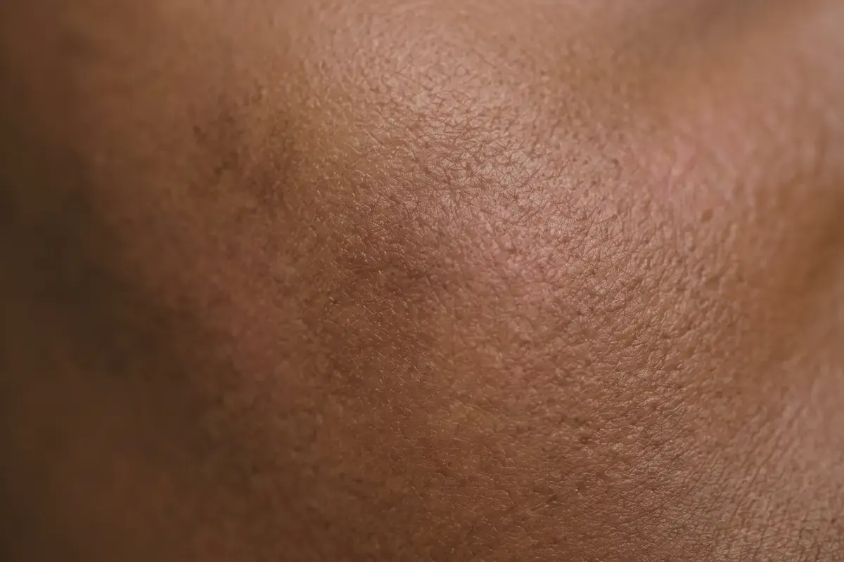 Close detail of smooth flat skin carrying faint darker and pink discolouration with no change in texture